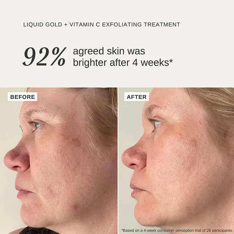 Alpha-H Liquid Gold Exfoliating Treatment with Vitamin C