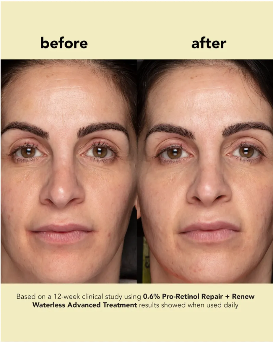 Boscia 0.6% Pro-Retinol Repair   Renew Waterless Advanced Treatment